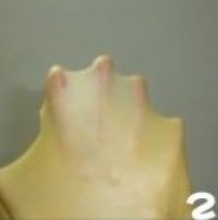 Step 2