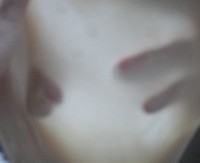 Step 2