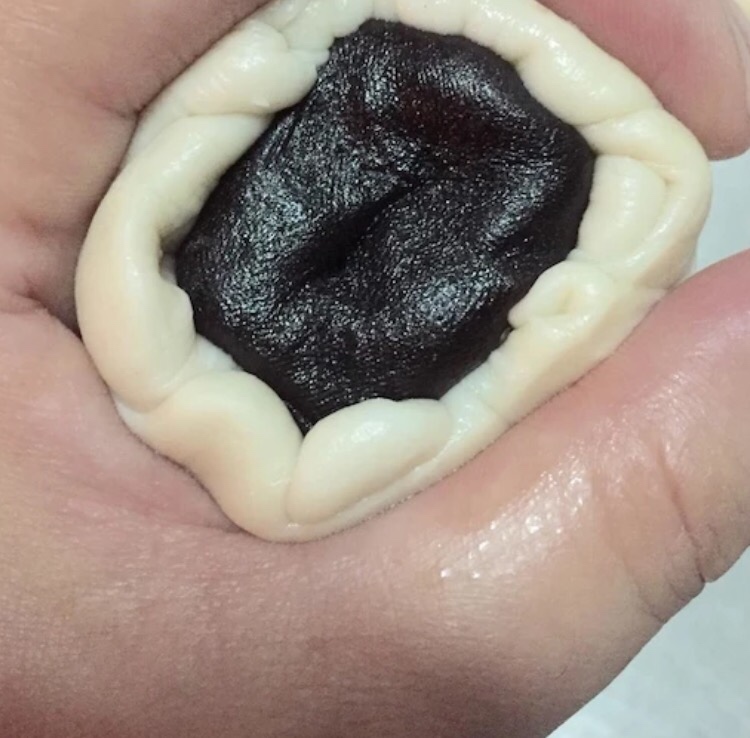 Step 7